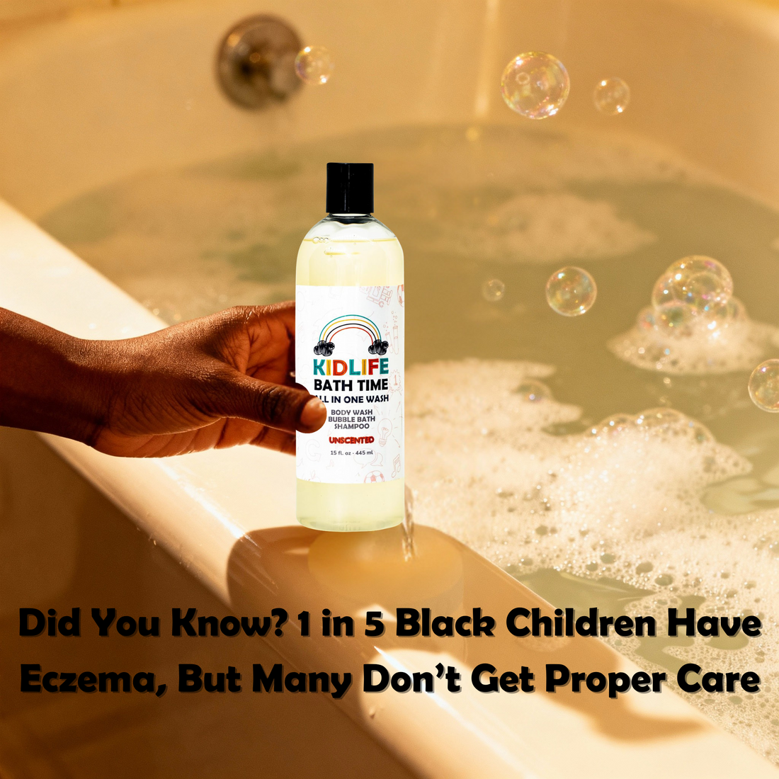 Did You Know? 1 in 5 Black Children Have Eczema, But Many Don’t Get Proper Care
